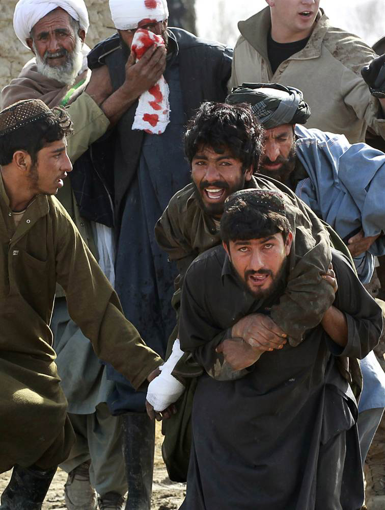 Раненные афганцы