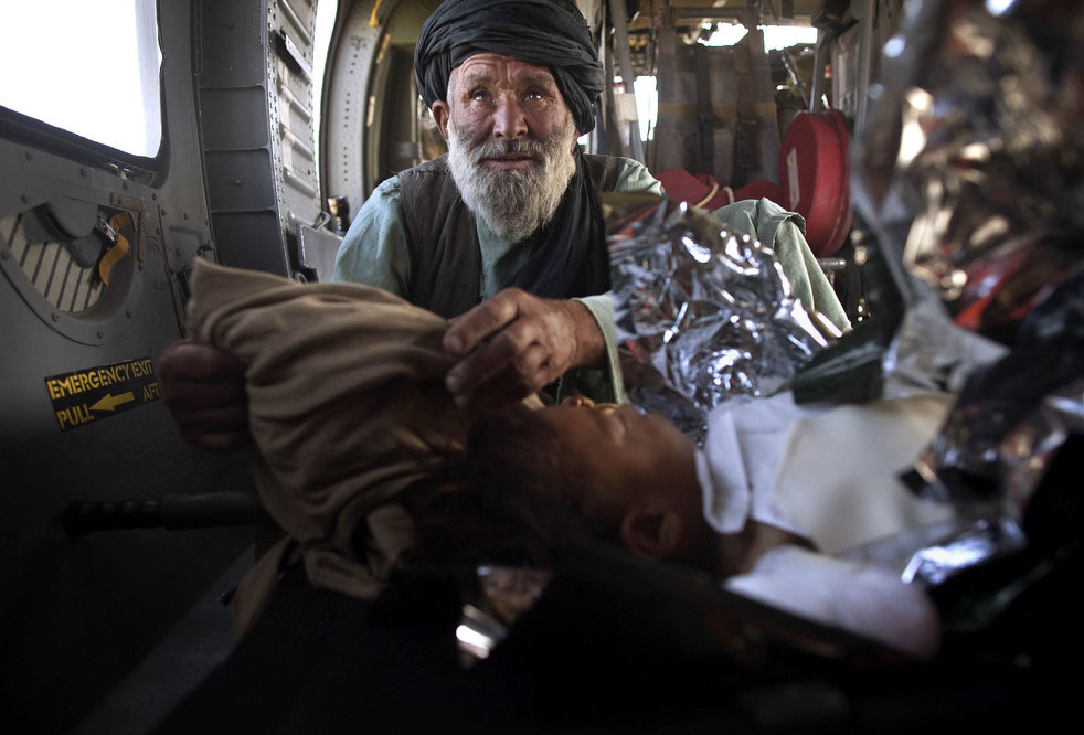 За раненым афганским мальчиком наблюдает его родственник