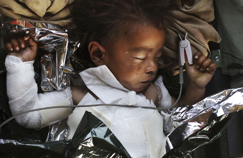 Раненый афганский мальчик