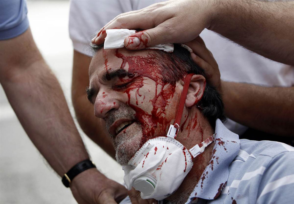 Раненный демонстрант