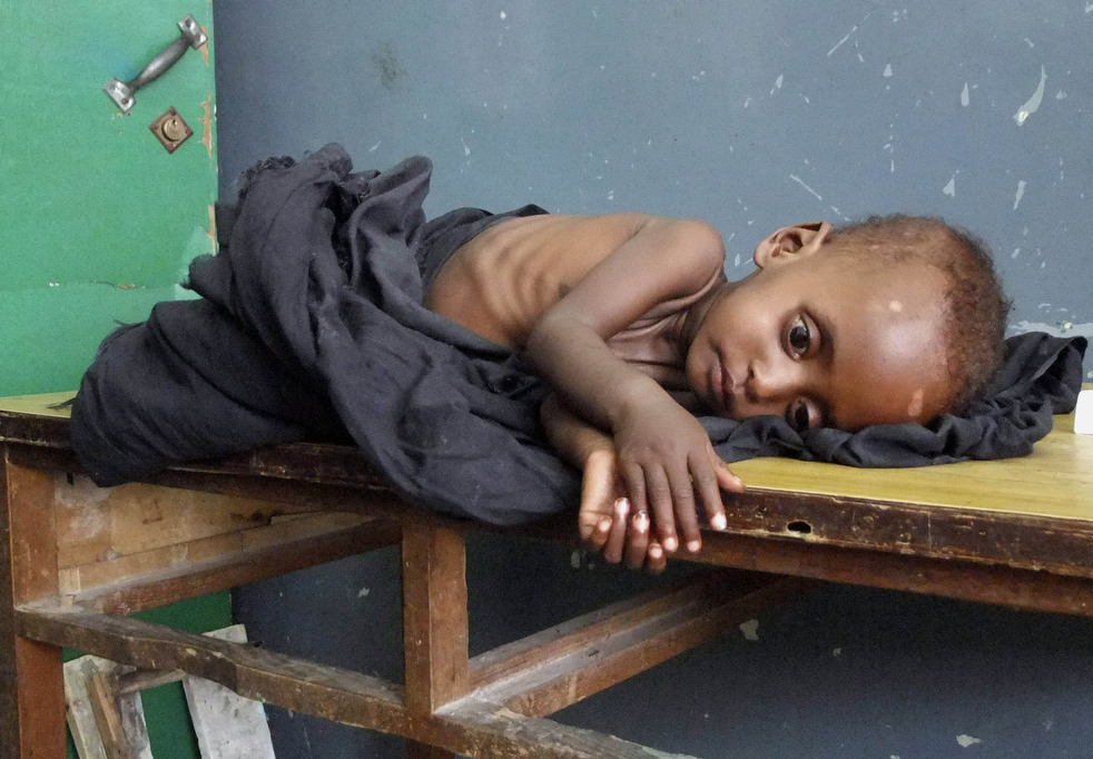 Больной сомалийский ребенок