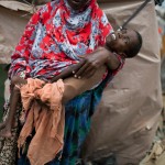Голод в Сомали