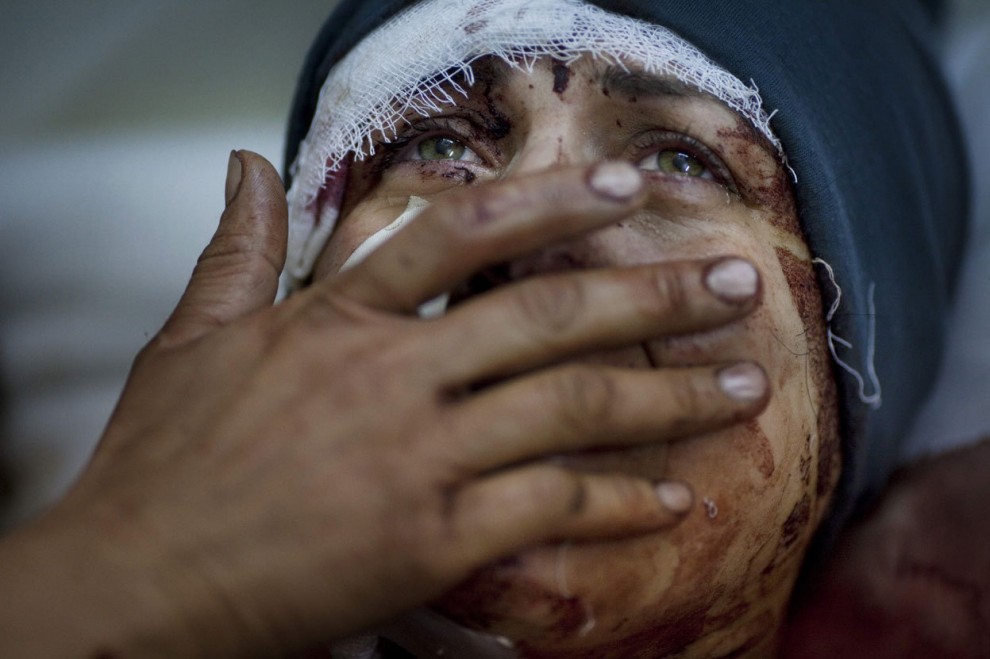 Раненная Сирийка