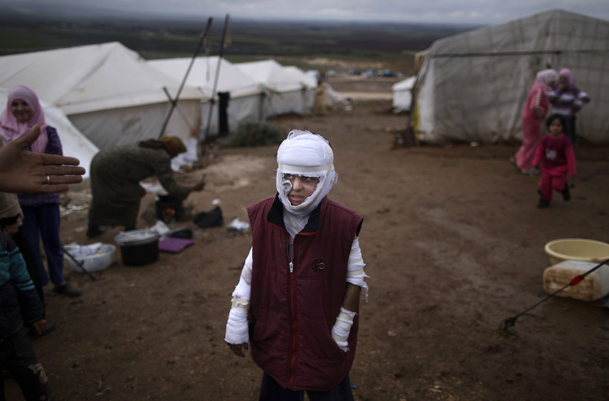 Раненный сирийский мальчик