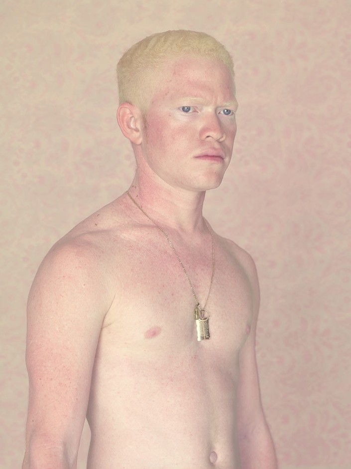 Люди-альбиносы