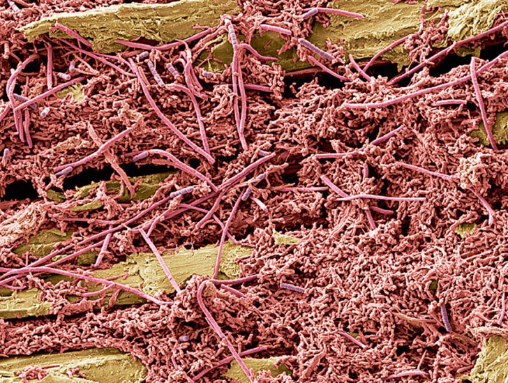 Бактерии во рту
