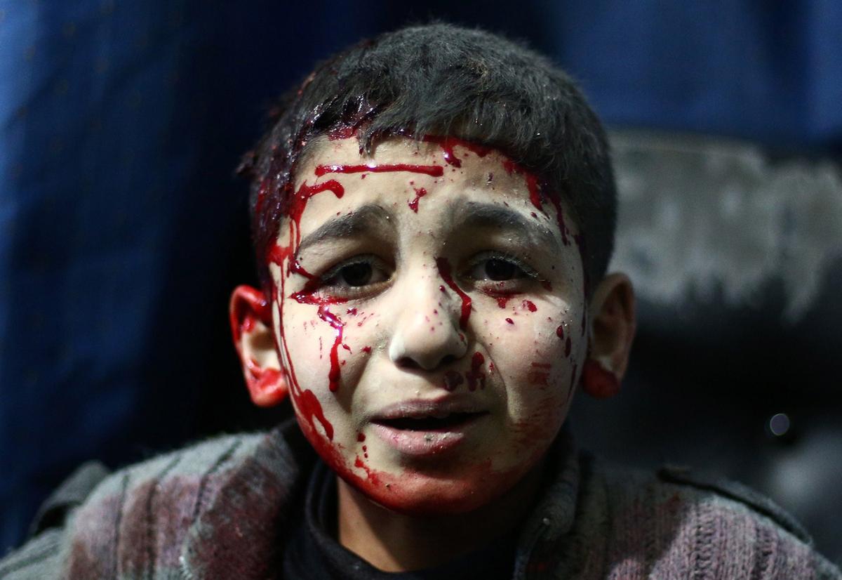 Раненный сирийский мальчик
