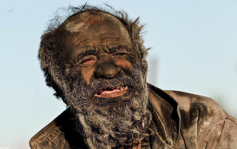 Как выглядит человек, который не мылся уже более 60 лет
