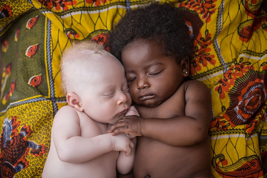 Чернокожий ребёнок и ребёнок-альбинос