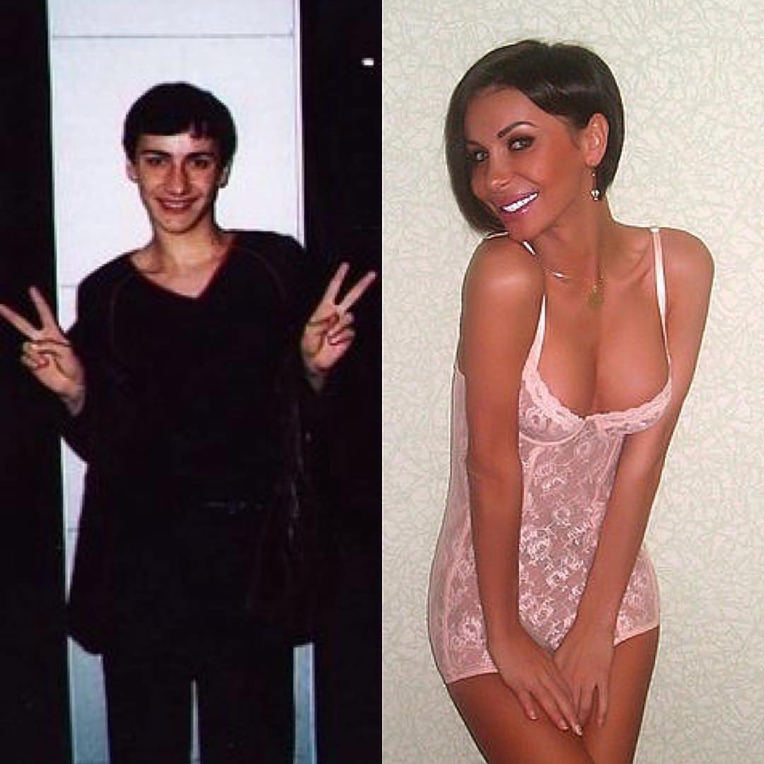 До и после: трансгендеры всего мира поделились фото своих трансформаций