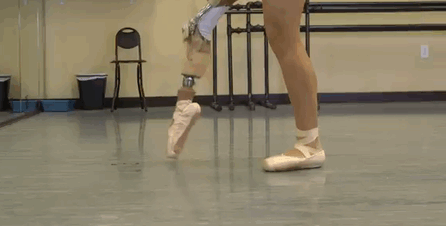 Танцовщица с ампутированной ногой
