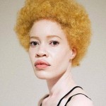 Афроамериканская модель-альбиноска Диандра Форрест ломает традиционные представления о красоте
