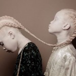 Сёстры-альбиноски покоряют мир моды своей уникальной красотой