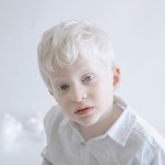 Гипнотическая красота людей с альбинизмом в новой серии фотографий Юлии Тайц